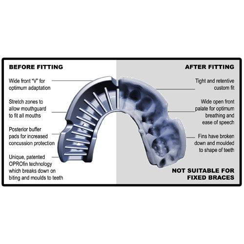 OPROShield | Mouth Guard - Platinum - XTC Fitness - Exercise Equipment Superstore - Canada - Mouth Guards